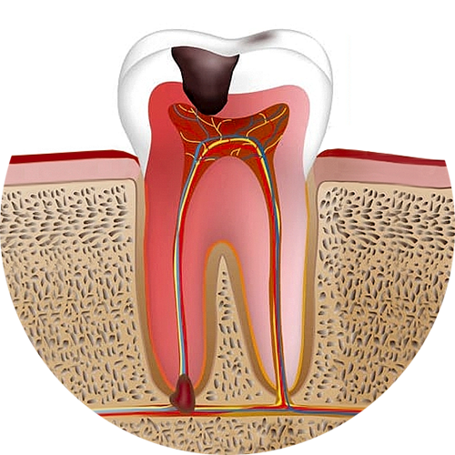 Эндодонтия 1