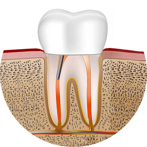 Эндодонтия 6
