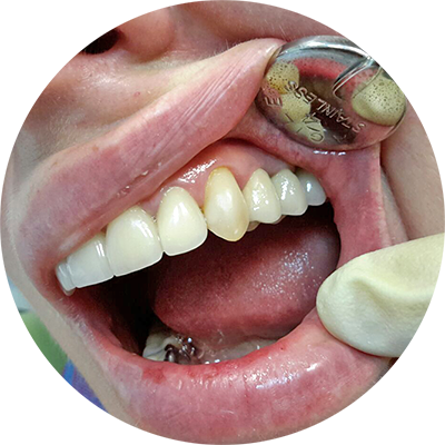 Угадай где зуб