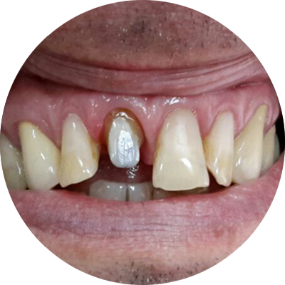 Работы ПрофиСтом