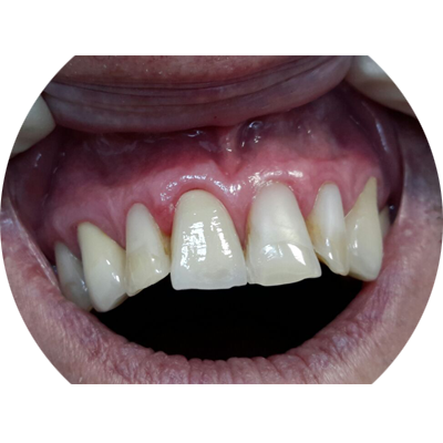 Работы ПрофиСтом